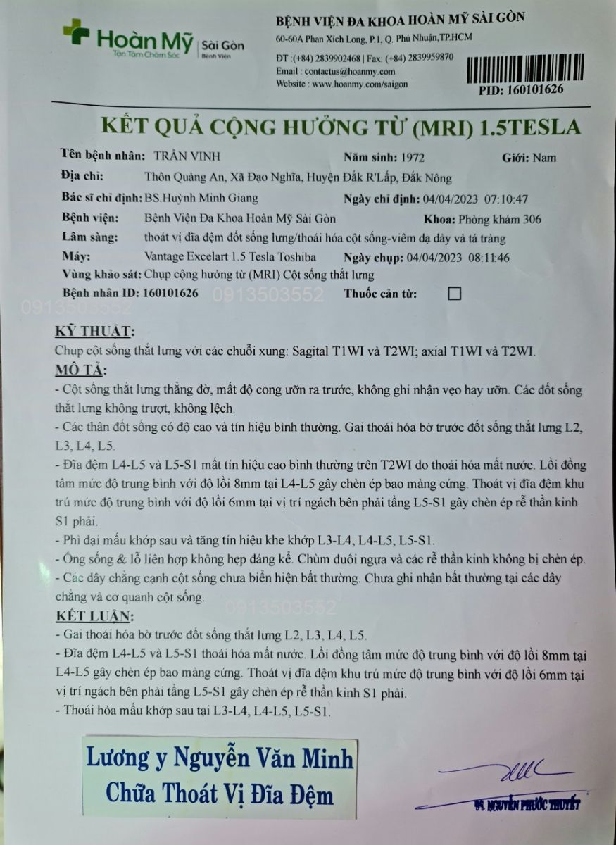 Lồi đĩa đệm L4-L5